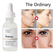 The Ordinary Niacinamide 10% + Zinc 1% Face Serum